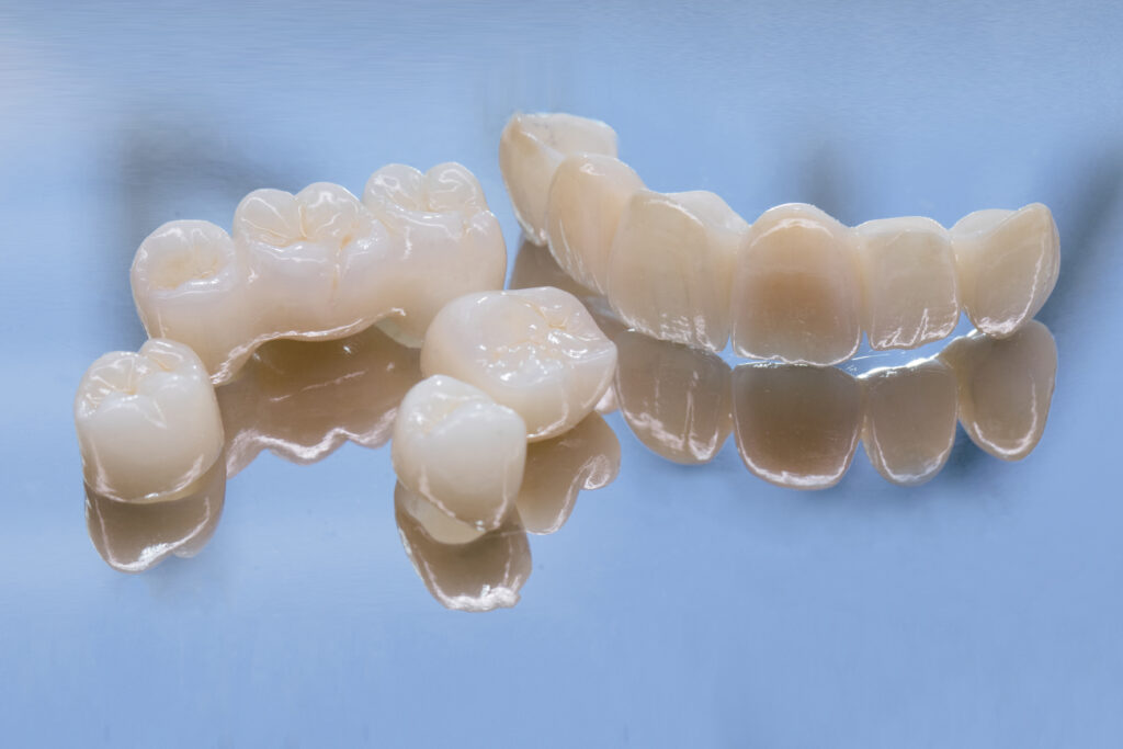 garland dental crowns